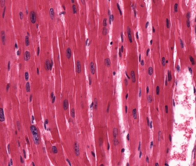 Cardiac Muscle Fiber