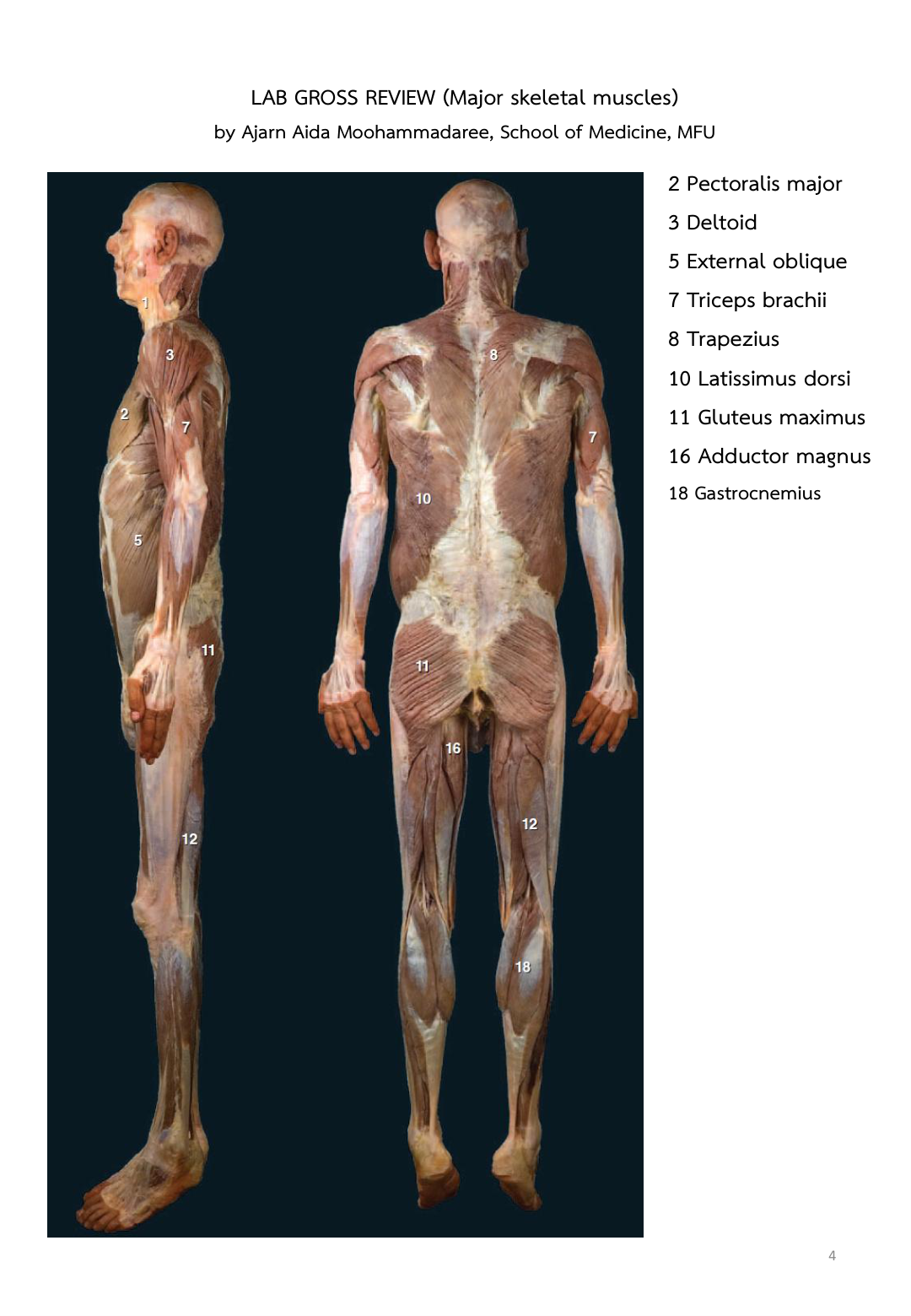 Figure 6: Cadaver Dissection Review - Posterior Muscles (Checklist Review Page 4)