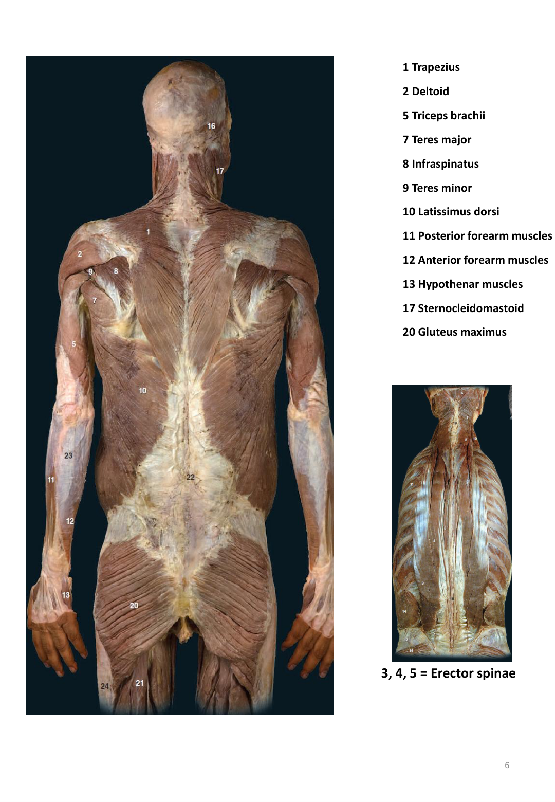 Figure 4: Muscles of the Thigh (Quadriceps, Sartorius, Gracilis, Hamstrings) - Lab Manual Page 61