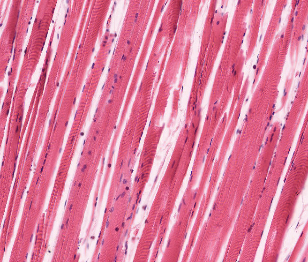 Skeletal Muscle Fiber
