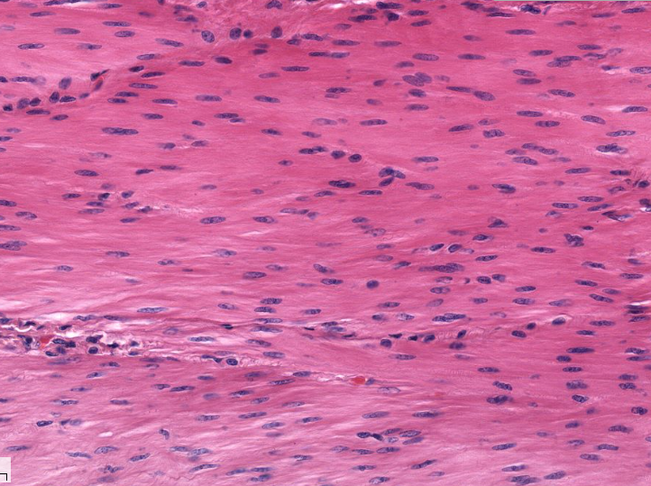 Smooth Muscle Cells